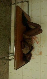 مجموعة صور للجريمة السعوأمريكية في مديرية زبيد بالحديدة