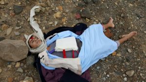 صنعاء-انتحاري-الامن-1-768x432