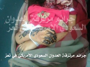 13349147_1541834876123550_270581342_n