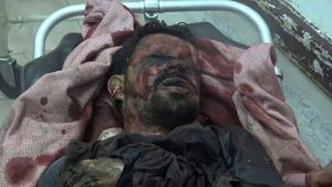 13950550_338104776521333_1979881020_o