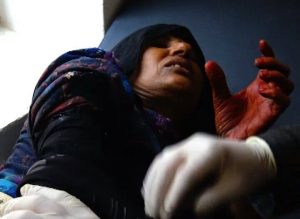 جرح-امرأة-في-قصف-سعودي-على-صعدة