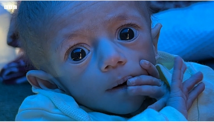 الأمم المتحدة: غزة أكثر الأماكن جوعا على وجه الأرض